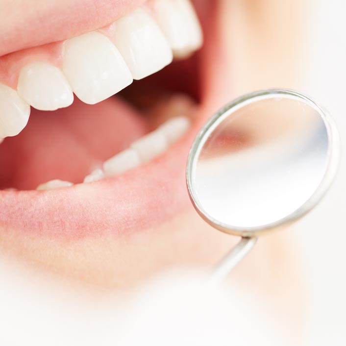 Dental Cleanings - Dental Services